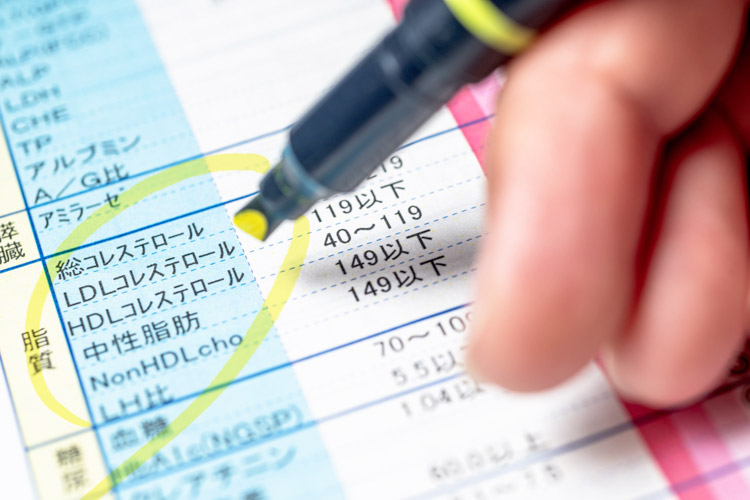 脂質異常症(高脂血症)のイメージ画像